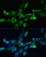 FDFT1 Antibody in Immunocytochemistry (ICC/IF)