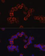 CD43 Antibody in Immunocytochemistry (ICC/IF)