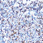 CD43 Antibody in Immunohistochemistry (Paraffin) (IHC (P))