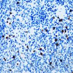 CD43 Antibody in Immunohistochemistry (Paraffin) (IHC (P))