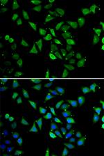 eIF3c Antibody in Immunocytochemistry (ICC/IF)