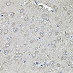 eIF3c Antibody in Immunohistochemistry (Paraffin) (IHC (P))