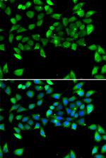 eIF3h Antibody in Immunocytochemistry (ICC/IF)