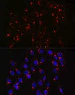 COPB2 Antibody in Immunocytochemistry (ICC/IF)