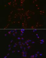 COPB2 Antibody in Immunocytochemistry (ICC/IF)