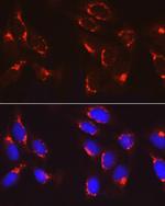 COPB2 Antibody in Immunocytochemistry (ICC/IF)