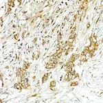 COPB2 Antibody in Immunohistochemistry (Paraffin) (IHC (P))