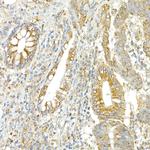 COPB2 Antibody in Immunohistochemistry (Paraffin) (IHC (P))