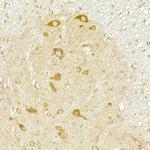 COPB2 Antibody in Immunohistochemistry (Paraffin) (IHC (P))