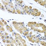 OGFR Antibody in Immunohistochemistry (Paraffin) (IHC (P))