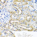 OGFR Antibody in Immunohistochemistry (Paraffin) (IHC (P))