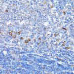 NDE1 Antibody in Immunohistochemistry (Paraffin) (IHC (P))