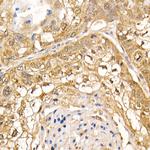 STS1 Antibody in Immunohistochemistry (Paraffin) (IHC (P))