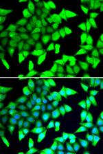 HDAC5 Antibody in Immunocytochemistry (ICC/IF)