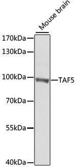 TAF5 Antibody in Western Blot (WB)