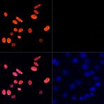 H3K27ac Antibody in Immunocytochemistry (ICC/IF)