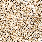 H3K27ac Antibody in Immunohistochemistry (Paraffin) (IHC (P))