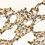 H3K27ac Antibody in Immunohistochemistry (Paraffin) (IHC (P))