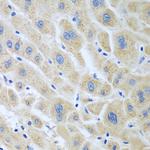 Flavin reductase Antibody in Immunohistochemistry (Paraffin) (IHC (P))