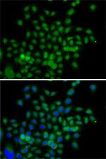 BCAS3 Antibody in Immunocytochemistry (ICC/IF)