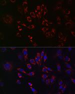 TFEB Antibody in Immunocytochemistry (ICC/IF)