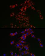 TFEB Antibody in Immunocytochemistry (ICC/IF)