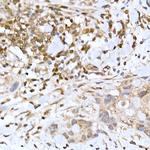 TFEB Antibody in Immunohistochemistry (Paraffin) (IHC (P))