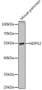 CALCOCO2 Antibody in Western Blot (WB)