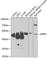 AEBP2 Antibody in Western Blot (WB)