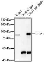 STIM1 Antibody in Immunoprecipitation (IP)