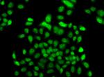 FBXO7 Antibody in Immunocytochemistry (ICC/IF)