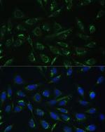 HCCS Antibody in Immunocytochemistry (ICC/IF)