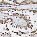 TRBP Antibody in Immunohistochemistry (Paraffin) (IHC (P))