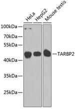 TRBP Antibody in Western Blot (WB)