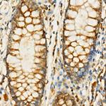 eIF4G Antibody in Immunohistochemistry (Paraffin) (IHC (P))