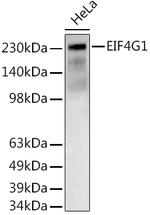 eIF4G Antibody in Western Blot (WB)