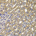 Cyclin A2 Antibody in Immunohistochemistry (Paraffin) (IHC (P))