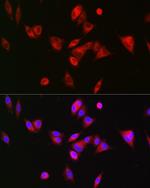 BAAT Antibody in Immunocytochemistry (ICC/IF)