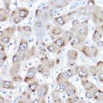 BAAT Antibody in Immunohistochemistry (Paraffin) (IHC (P))