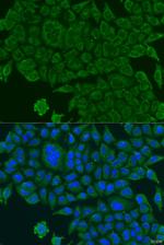 BCS1L Antibody in Immunocytochemistry (ICC/IF)