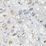 BCS1L Antibody in Immunohistochemistry (Paraffin) (IHC (P))