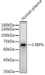 C4BPA Antibody in Western Blot (WB)