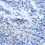 Chk1 Antibody in Immunohistochemistry (Paraffin) (IHC (P))