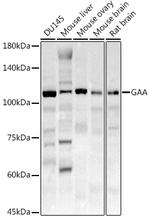 GAA Antibody in Western Blot (WB)