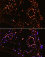 YBX1 Antibody in Immunohistochemistry (Paraffin) (IHC (P))