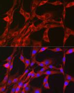 PGD Antibody in Immunocytochemistry (ICC/IF)