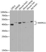 p38 MAPK beta Antibody in Western Blot (WB)