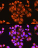 PSEN2 Antibody in Immunocytochemistry (ICC/IF)