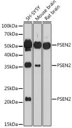 PSEN2 Antibody in Western Blot (WB)