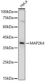 MAP2K4 Antibody in Western Blot (WB)